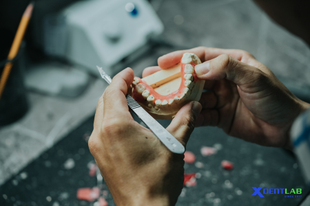 Dental Lab Services