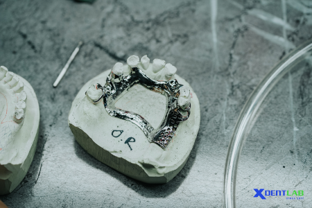 Dental Lab Services
