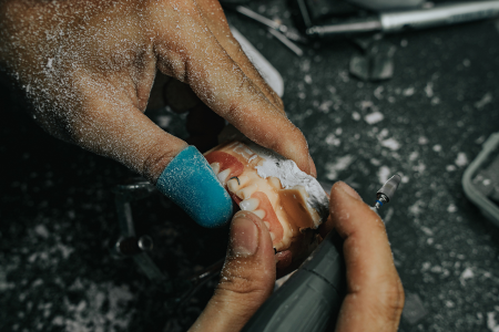 Dental Lab Services