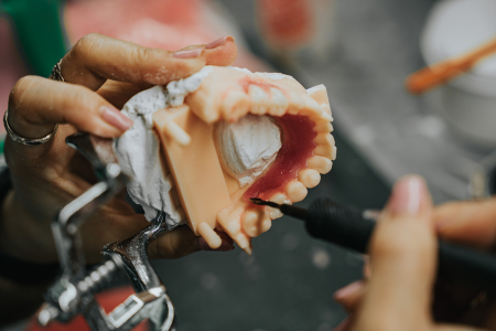Dental Lab Services