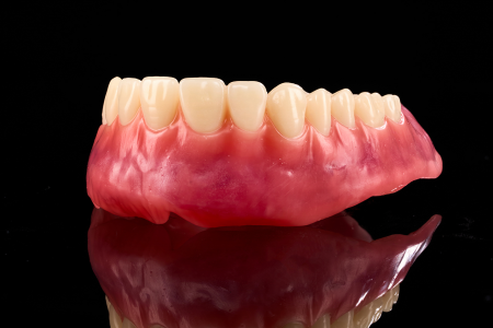 Full Denture