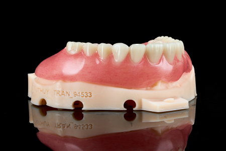 Full Denture