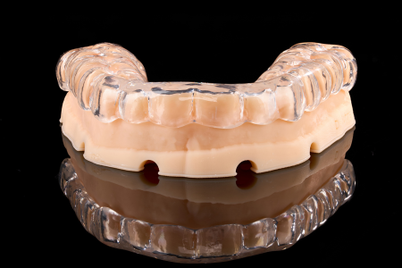 Occlusal Appliance