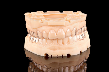 Occlusal Appliance