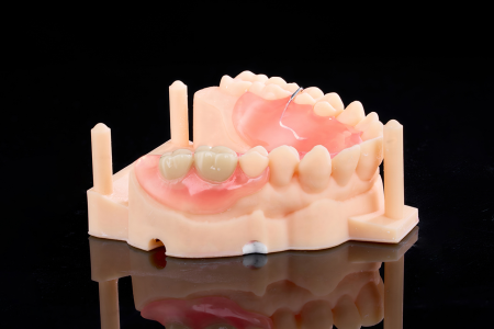 Partial Denture