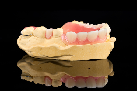 Partial Denture