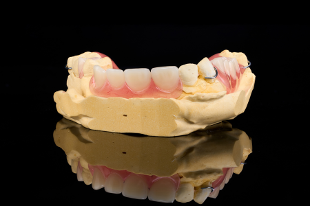 Partial Denture
