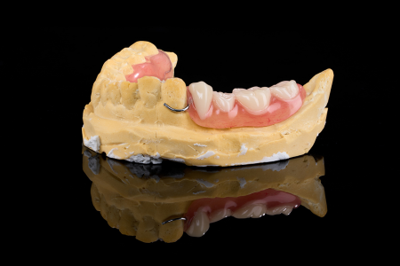 Partial Denture