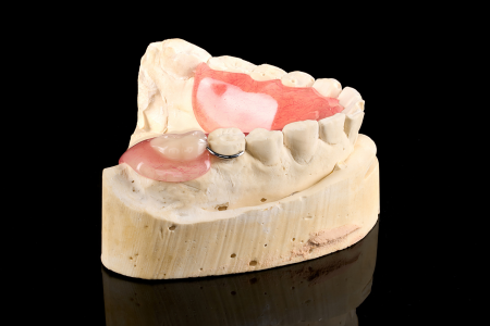 Partial Denture