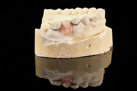 Partial Denture
