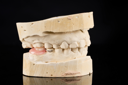 Partial Denture