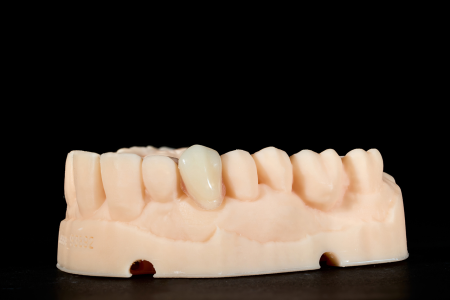 Partial Denture