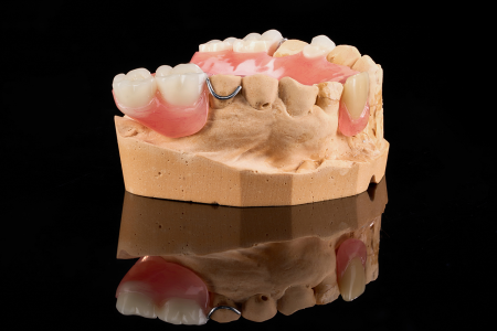 Partial Denture