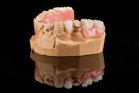 Partial Denture