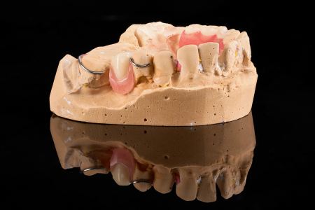 Partial Denture