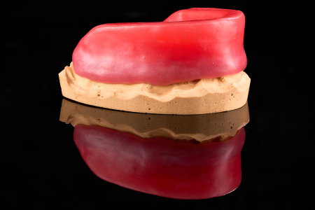 Partial Denture