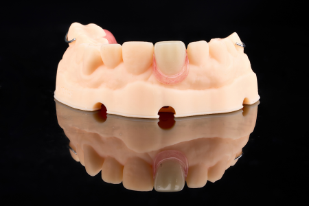 Partial Denture