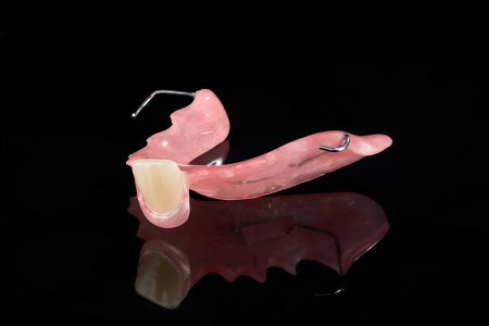 Partial Denture