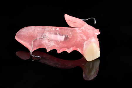 Partial Denture
