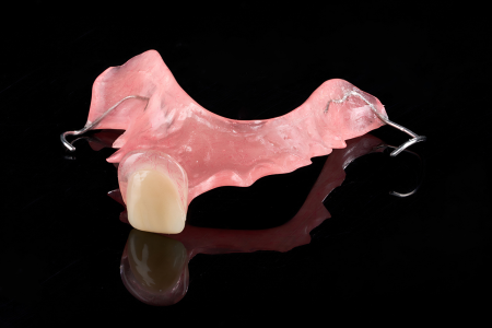 Partial Denture