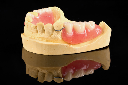 Partial Denture
