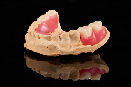 Partial Denture