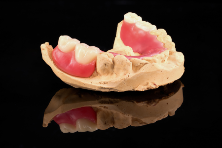 Partial Denture