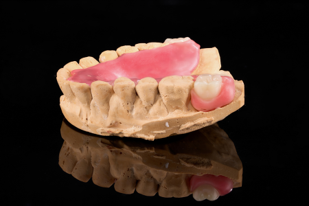 Partial Denture