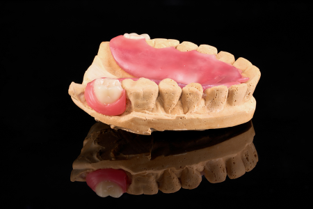 Partial Denture