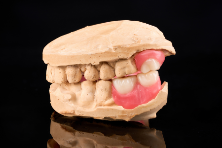 Partial Denture