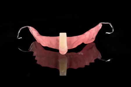 Partial Denture