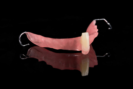 Partial Denture