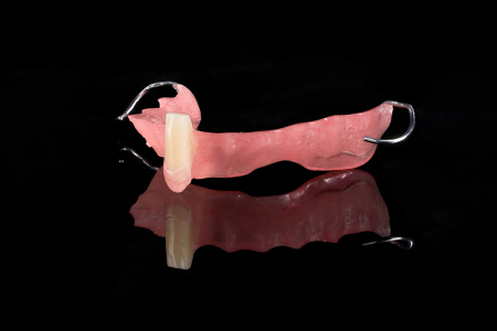 Partial Denture