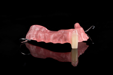 Partial Denture