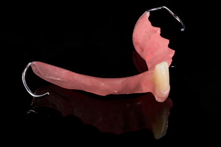 Partial Denture