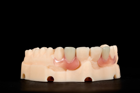 Partial Denture