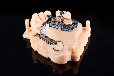 Partial Denture
