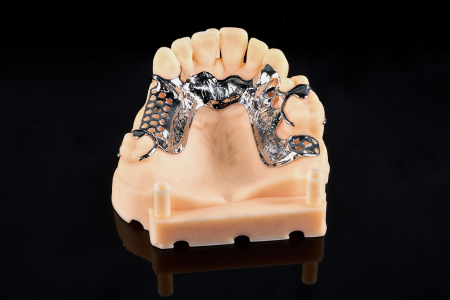 Partial Denture