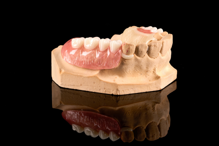 Partial Denture