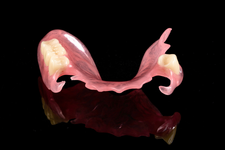 Partial Denture