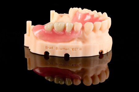 Partial Denture