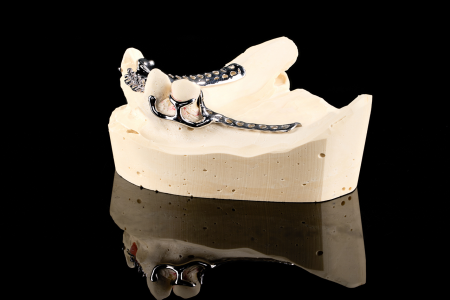Partial Denture