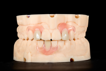 Partial Denture