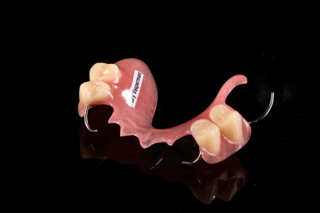 Partial Denture