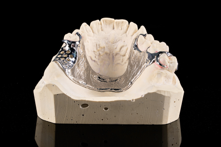 Partial Denture