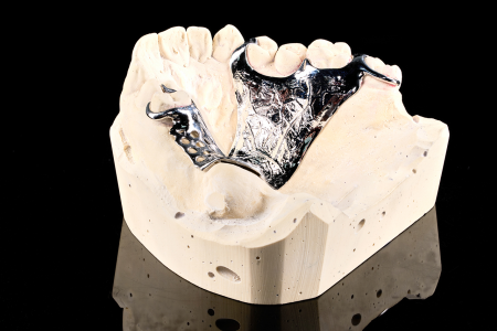 Partial Denture