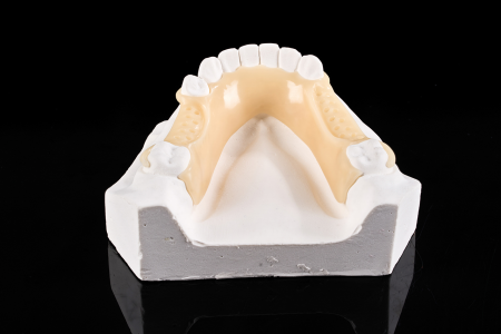 Partial Denture