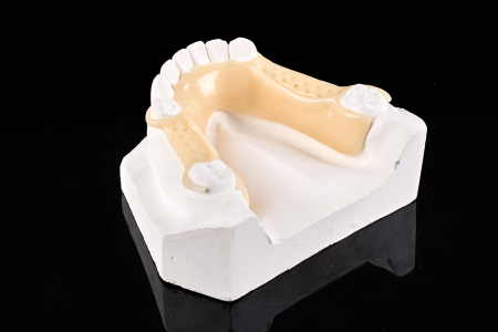 Partial Denture