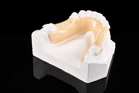 Partial Denture