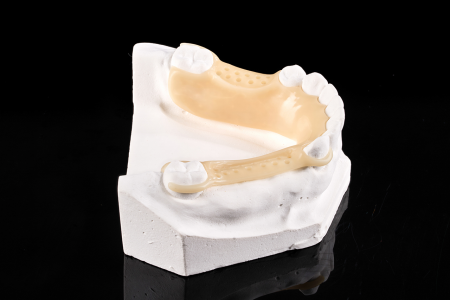 Partial Denture